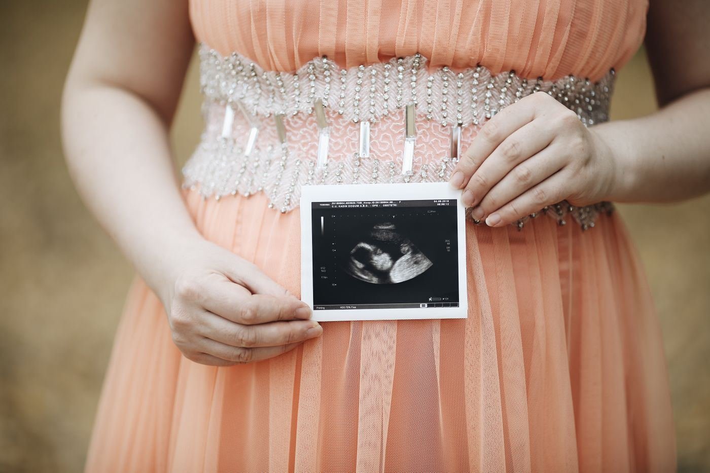Pregnant woman holding her ultrasound scan photo